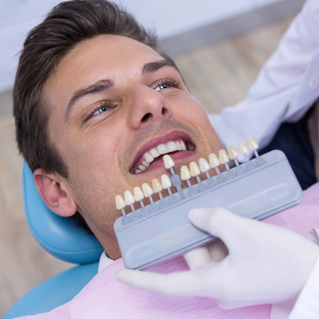 MALE TEETH WHITENING TREATMENT HITCHIN DENTAL PRACTICE scaled uai