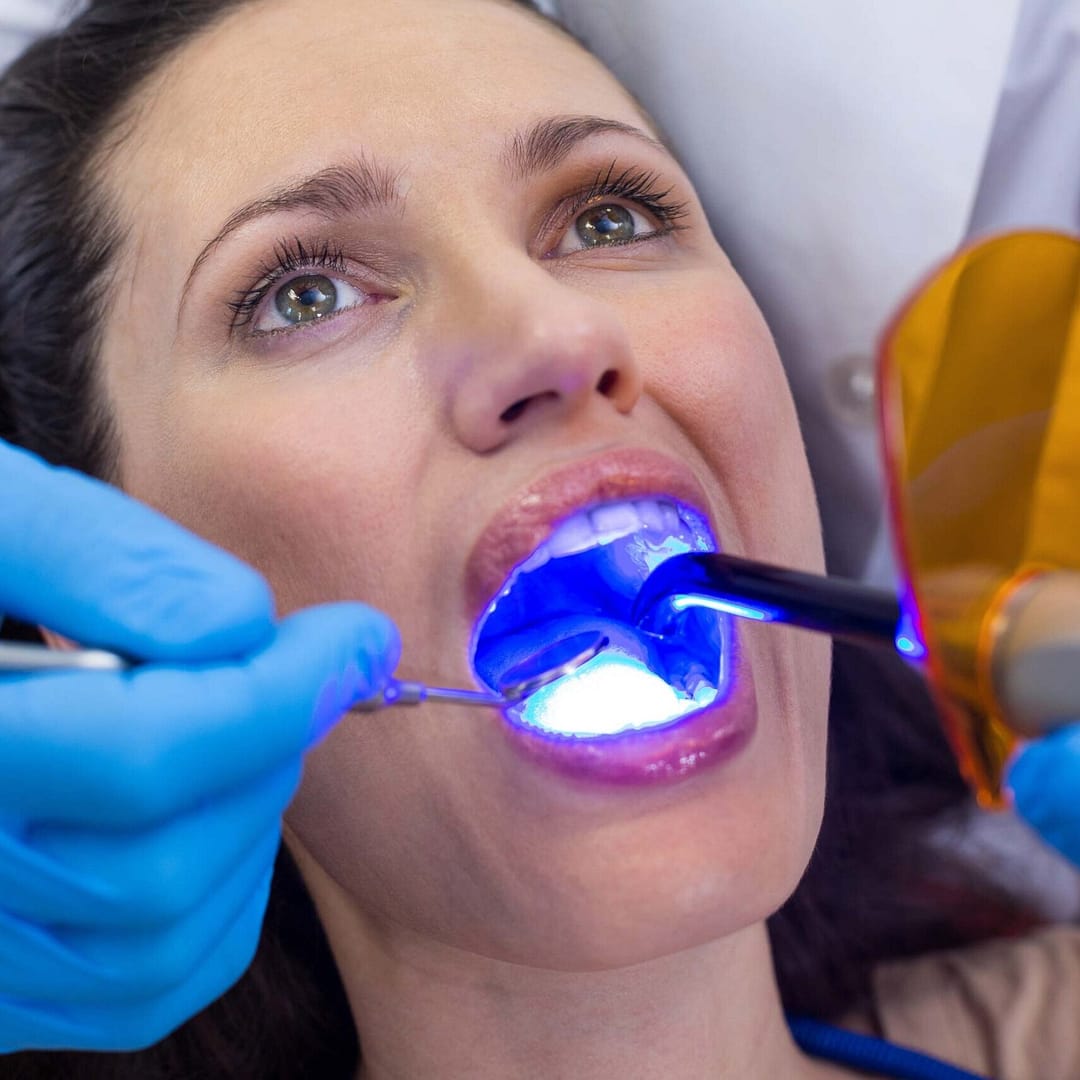 FEMALE TEETH WHITENING TREATMENT HITCHIN DENTAL PRACTICE scaled uai