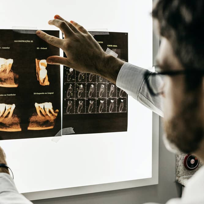 DENTAL IMPLANTS XRAY HITCHIN DENTIST PRACTICE uai